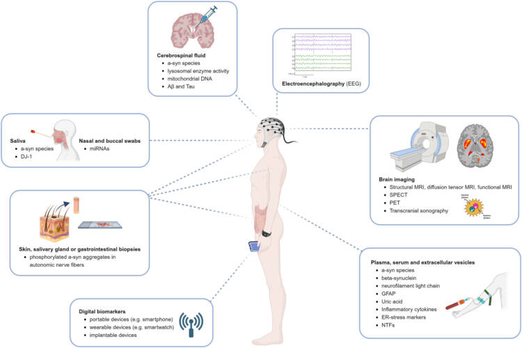 Kuva 2. Summary of biomarkers currently available or under investigation for Parkinson's disease. Julkaisun 24 kuva 1.